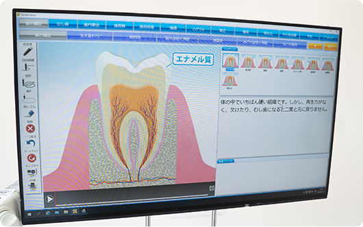 説明用モニター